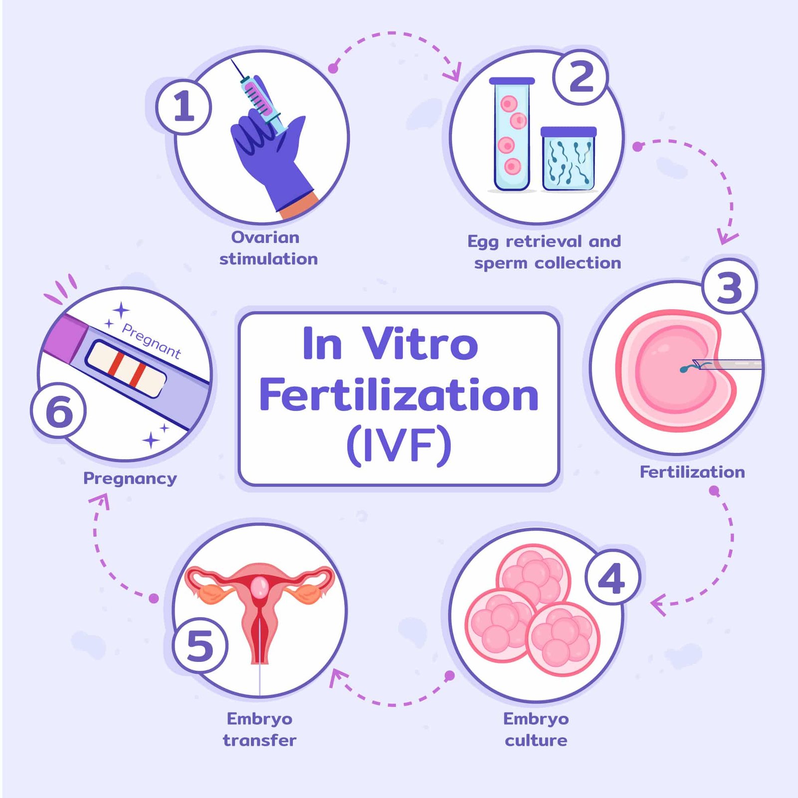 IVF Procedure 